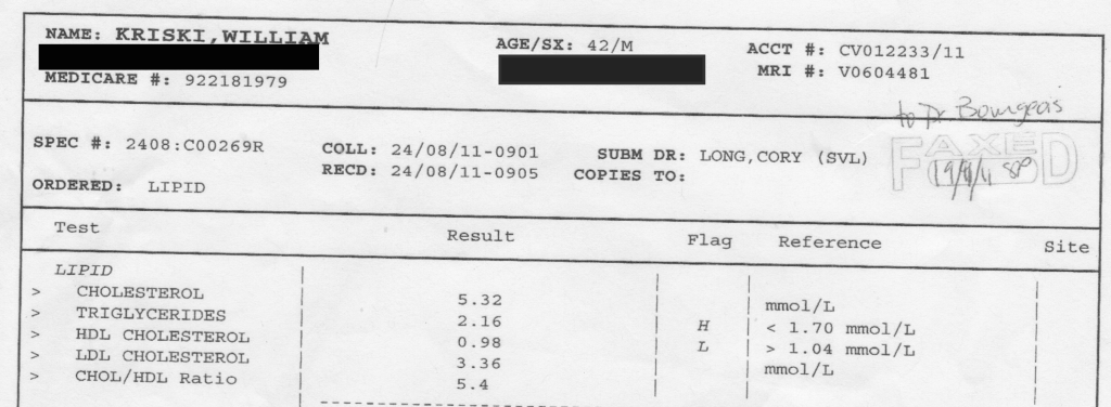 cholesterol test before